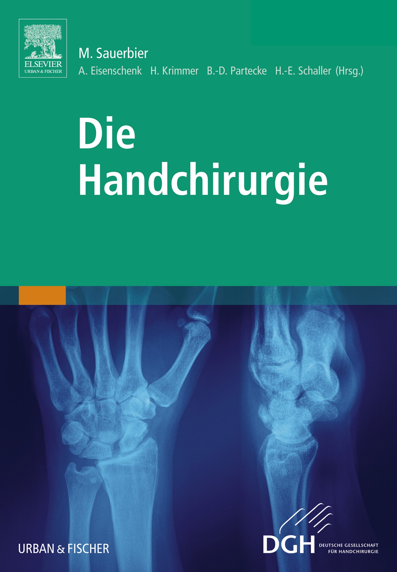 Die Handchirurgie - 9783437591457 | Elsevier GmbH