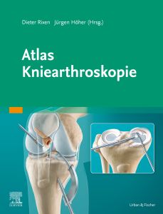 Atlas Kniearthroskopie