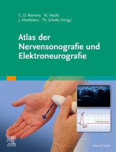 Atlas der Nervensonografie und Elektroneurografie