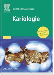 Kariologie und Füllungstherapie