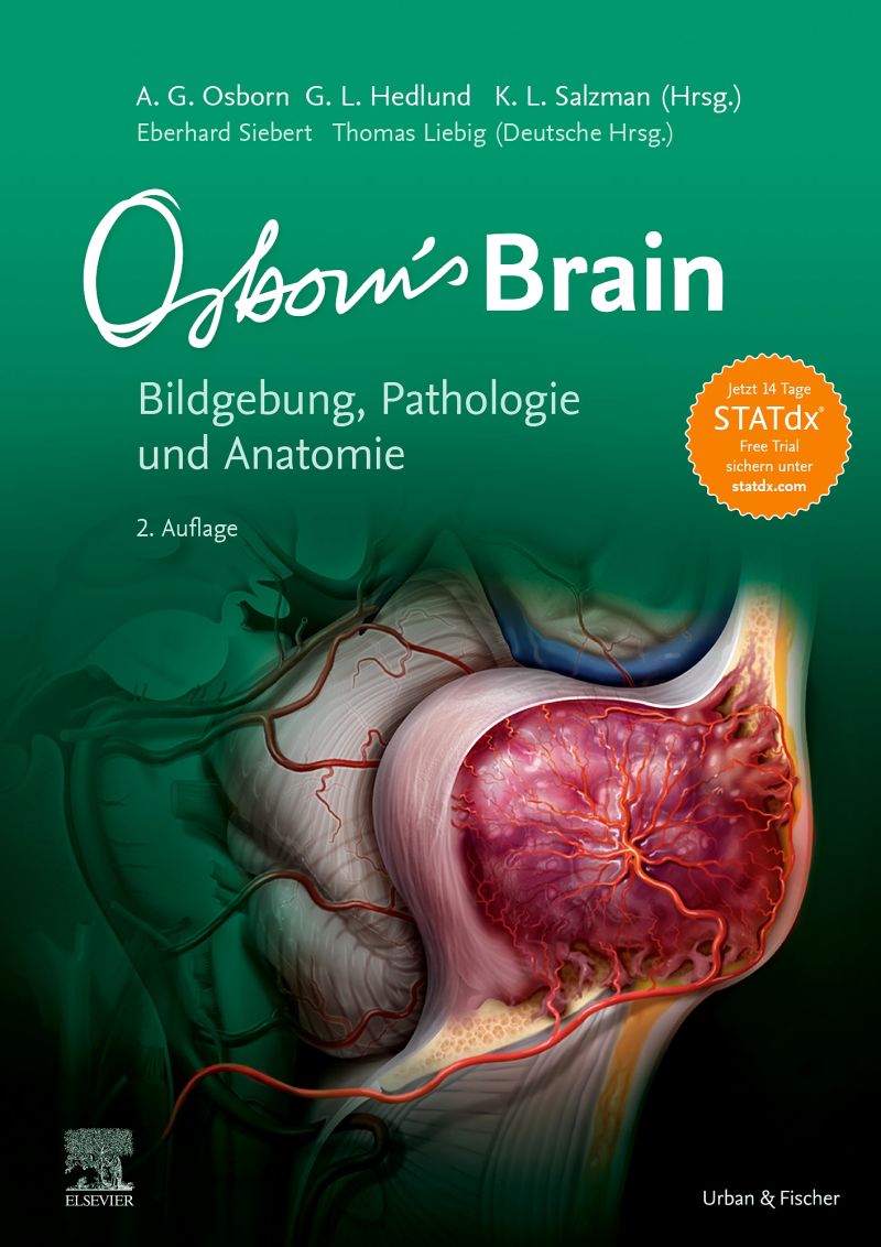 Osborn S Brain Elsevier Gmbh