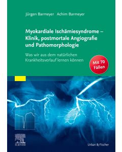 Myokardiale Ischämiesyndrome - Klinik, postmortale Angiografie und Pathomorphologie