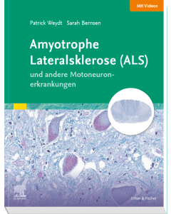 Amyotrophe Lateralsklerose (ALS) und andere Motoneuronerkrankungen