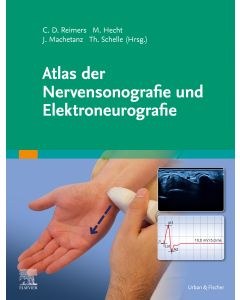 Atlas der Nervensonografie und Elektroneurografie