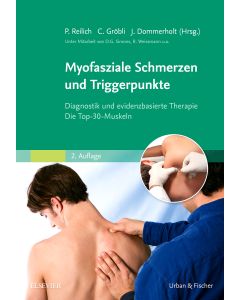 Myofasziale Schmerzen und Triggerpunkte