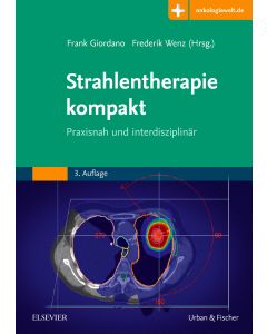 Strahlentherapie kompakt